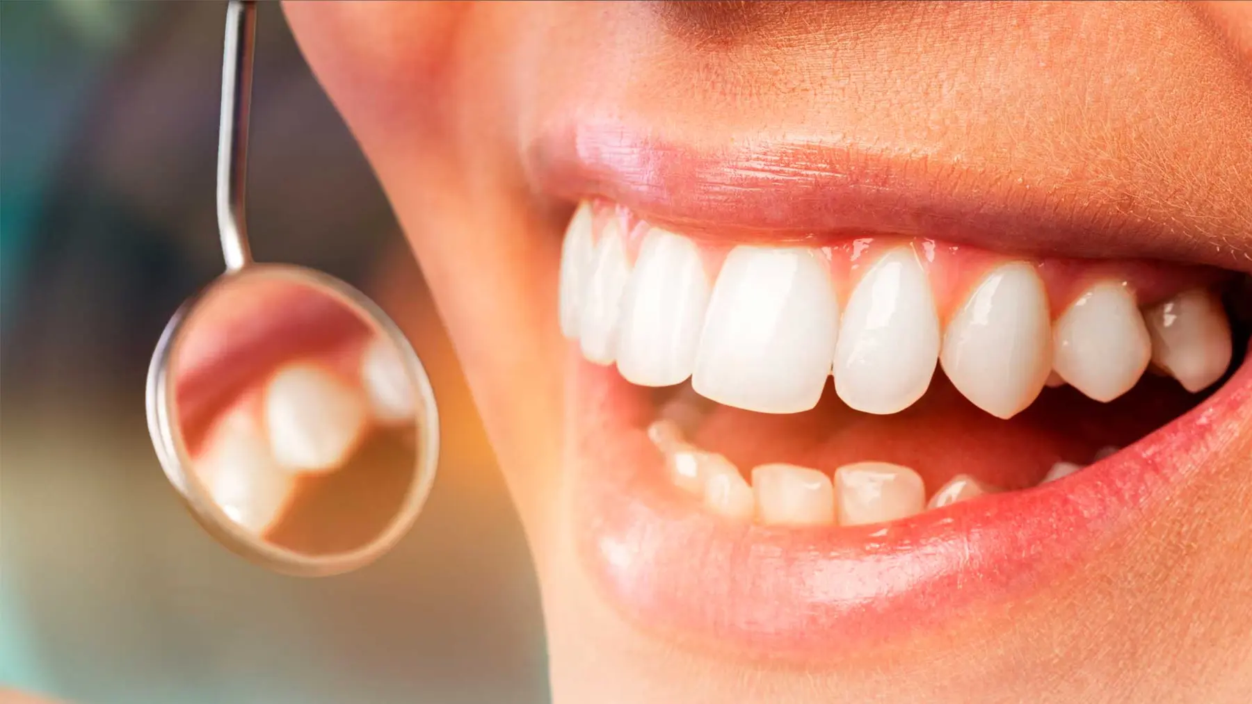 Una sonrisa vista de cerca durante una revisión, con el espejo dental
